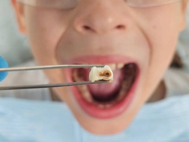 Best Emergency Treatment for Jaw Pain or Injury in Lafayette, IN